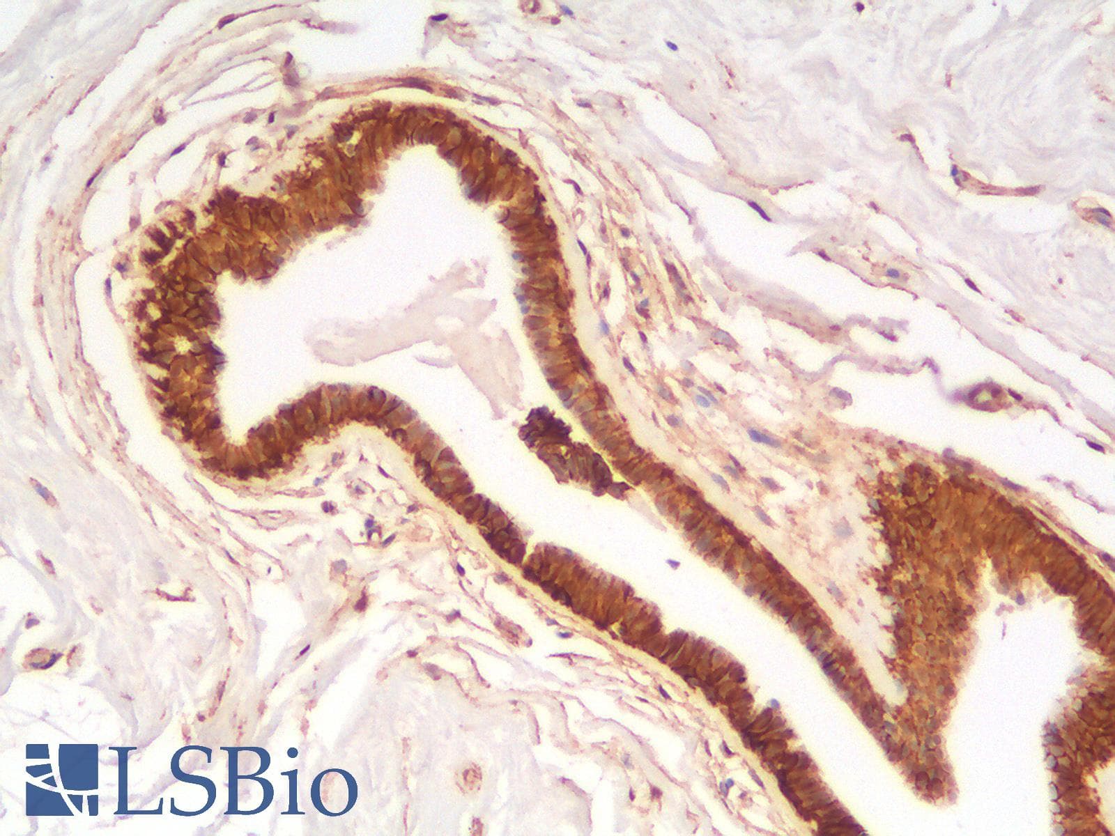 PathPlus™ CTNNB1 / Beta Catenin Antibody (clone rCTNNB1/2173)