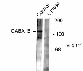 Polyclonal Rabbit anti-Rat GABBR2 / GABA B Receptor 2 Antibody (phospho-Ser783, IF, WB)