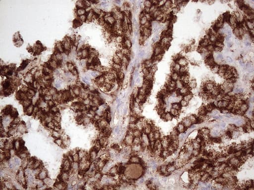 NR2C2 / TAK1 Antibody (aa1-241, clone OTI1B1)