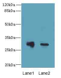 Polyclonal Rabbit anti-Human DNALI1 Antibody (IHC, WB)