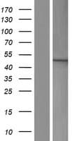 TBC1D20 Protein (Over-Expression Lysate Myc-DDK (Flag))