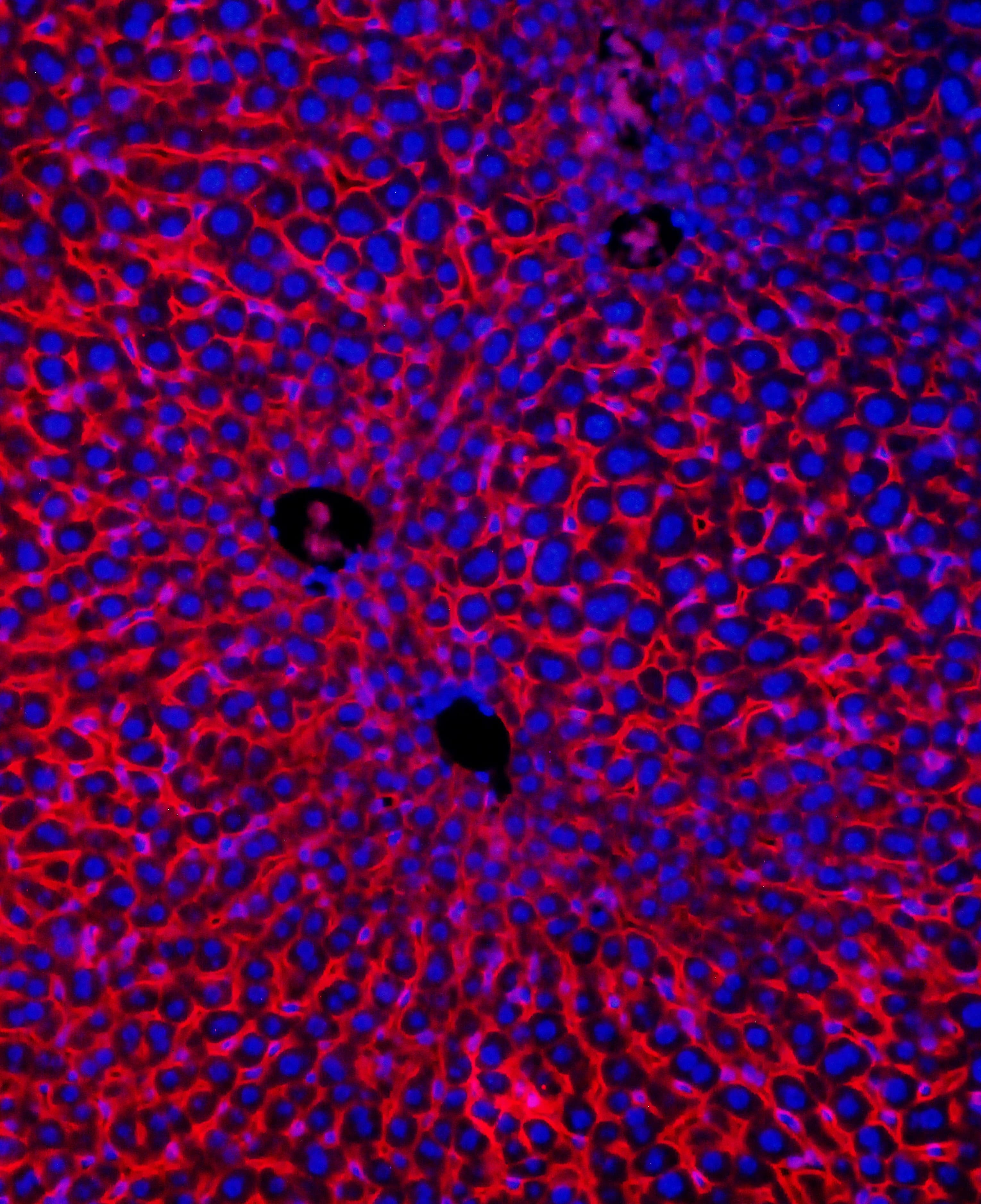 Polyclonal Rabbit anti-Mouse SLC10A1 / NTCP Antibody (aa296-336, IHC, WB)