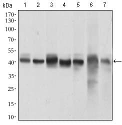 Monoclonal Mouse anti-Human MAPK14 / p38 Antibody (clone 8G4D11, aa299-360, IHC, IF, WB)