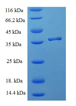 Human ICT1 / DS1 Protein (Recombinant His-SUMO)