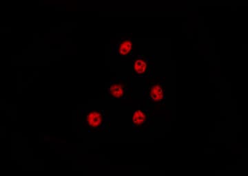 CSTF2T Antibody