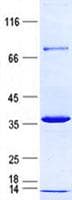 Human CDCA5 / Sororin Protein (Recombinant His, N-Terminal)