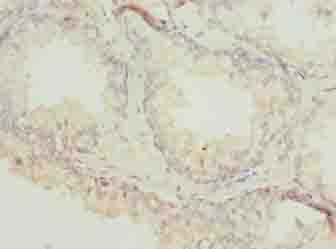 ACTL7B Antibody