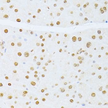 ER81 / ETV1 Antibody