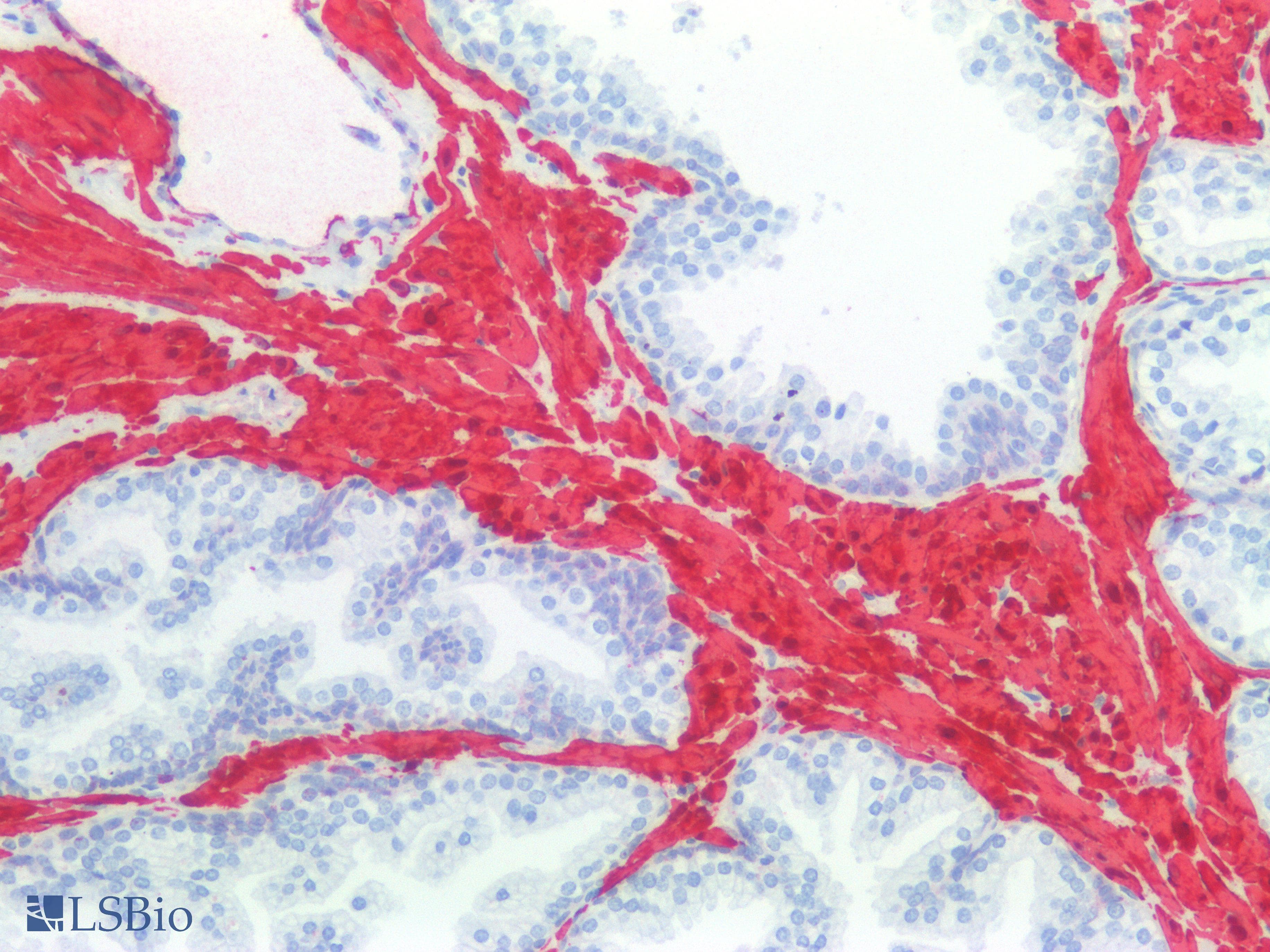 IHC-plus™ Monoclonal Mouse anti-Human CNN1 / Calponin Antibody (clone CALP, IHC)