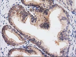 RASSF1 / RASSF1A Antibody (clone OTI2B11)