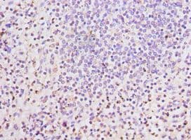 LSP1 Antibody (aa1-339)