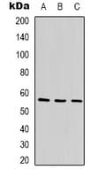 Polyclonal Rabbit anti-Human ANGPTL1 Antibody (Internal, WB)