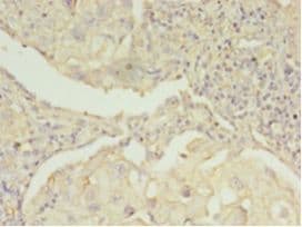 EBP Antibody (aa2-230)