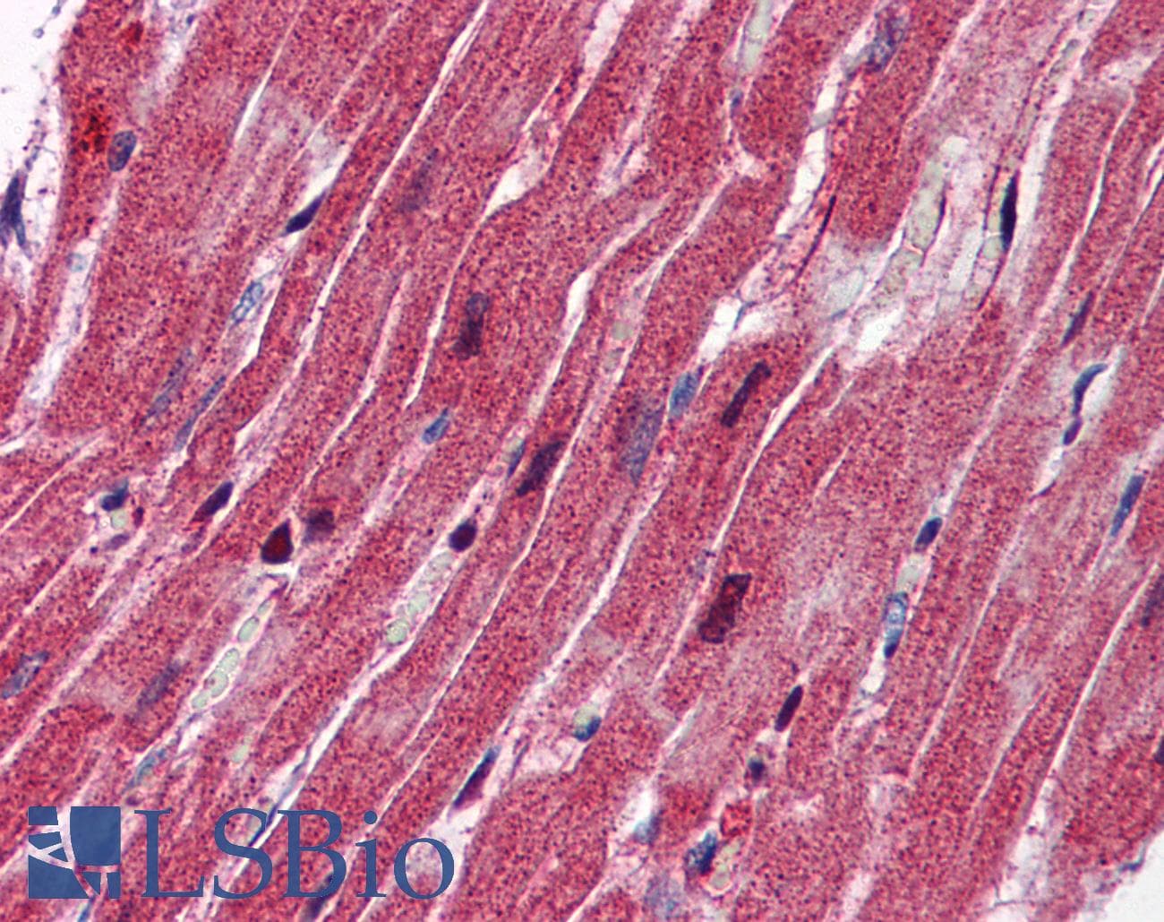 Polyclonal Rabbit anti-Human NES / Nestin Antibody (aa1295-1344, IHC, WB)