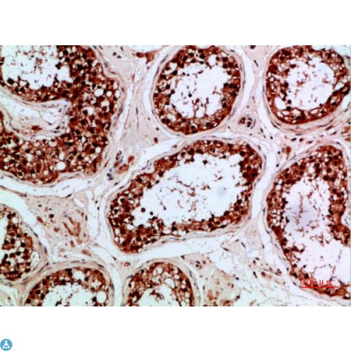 Polyclonal Rabbit anti-Human Proenkephalin / PENK Antibody (WB)