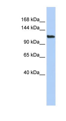 Polyclonal Rabbit anti-Human LAF4 / AFF3 Antibody (aa791-840, WB)