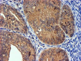 PDSS2 / DLP1 Antibody (clone OTI1D10)