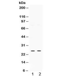 Polyclonal Rabbit anti-Human TK1 / TK / Thymidine Kinase Antibody (WB)