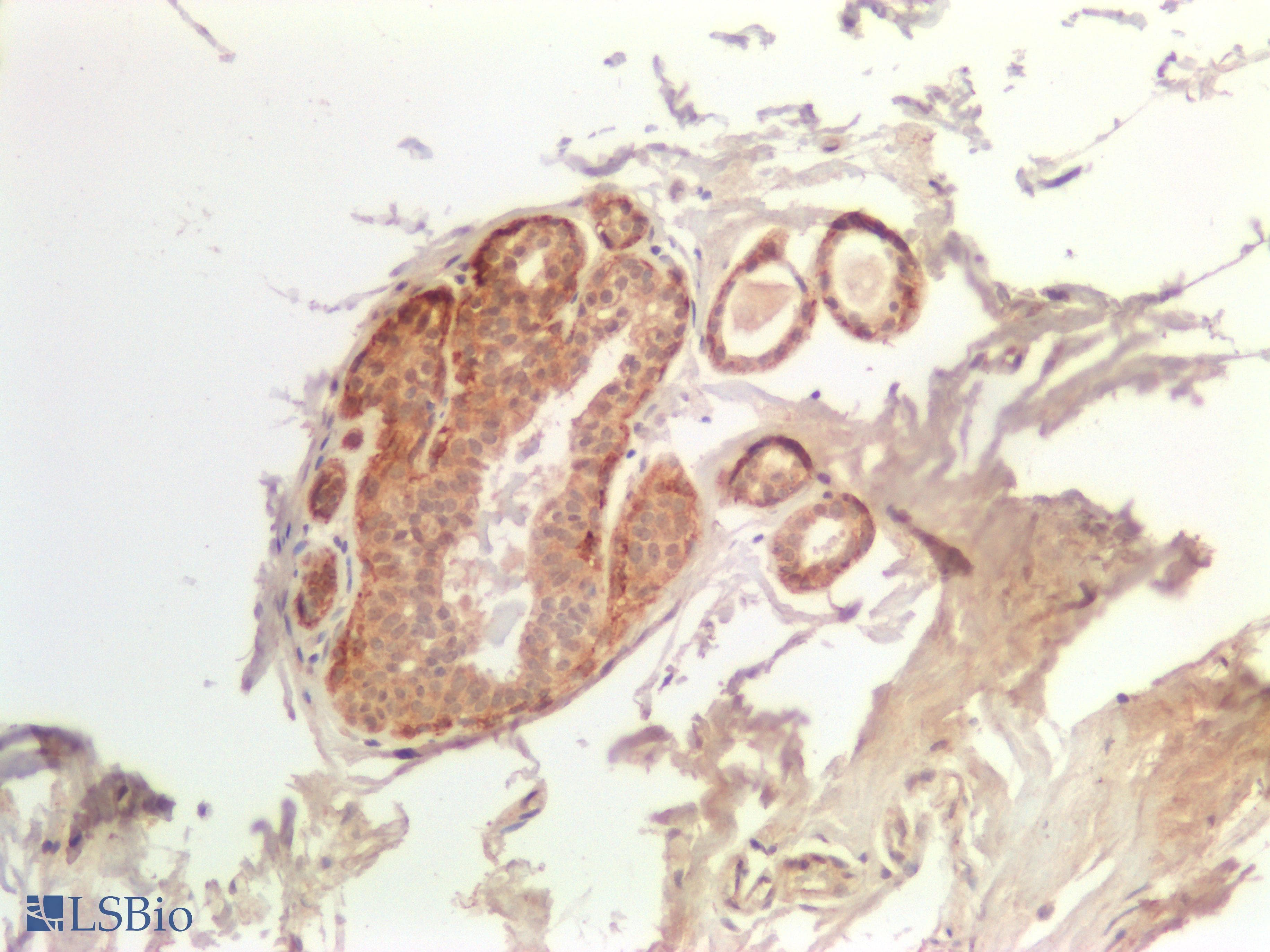 PathPlus™ Monoclonal Mouse anti-Human PDPN / Podoplanin Antibody (Concentrated, IHC)