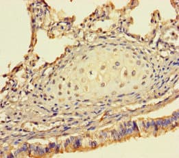 SHSF1 / SHFM1 Antibody
