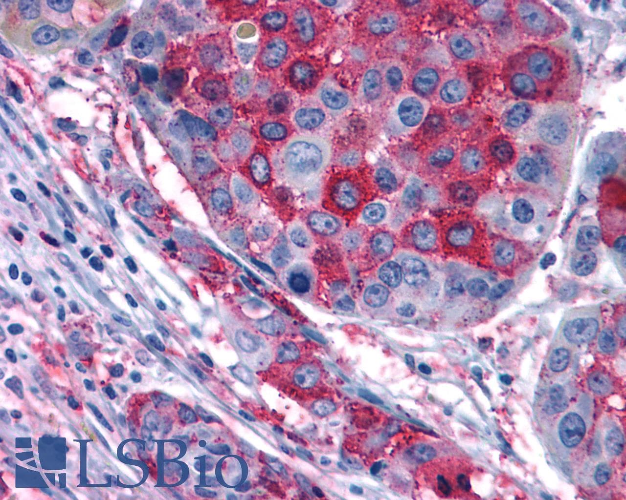 PathPlus™ GPR108 Antibody (Cytoplasmic Domain)