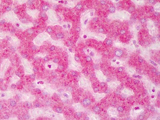 ABCB5 Antibody (Internal)