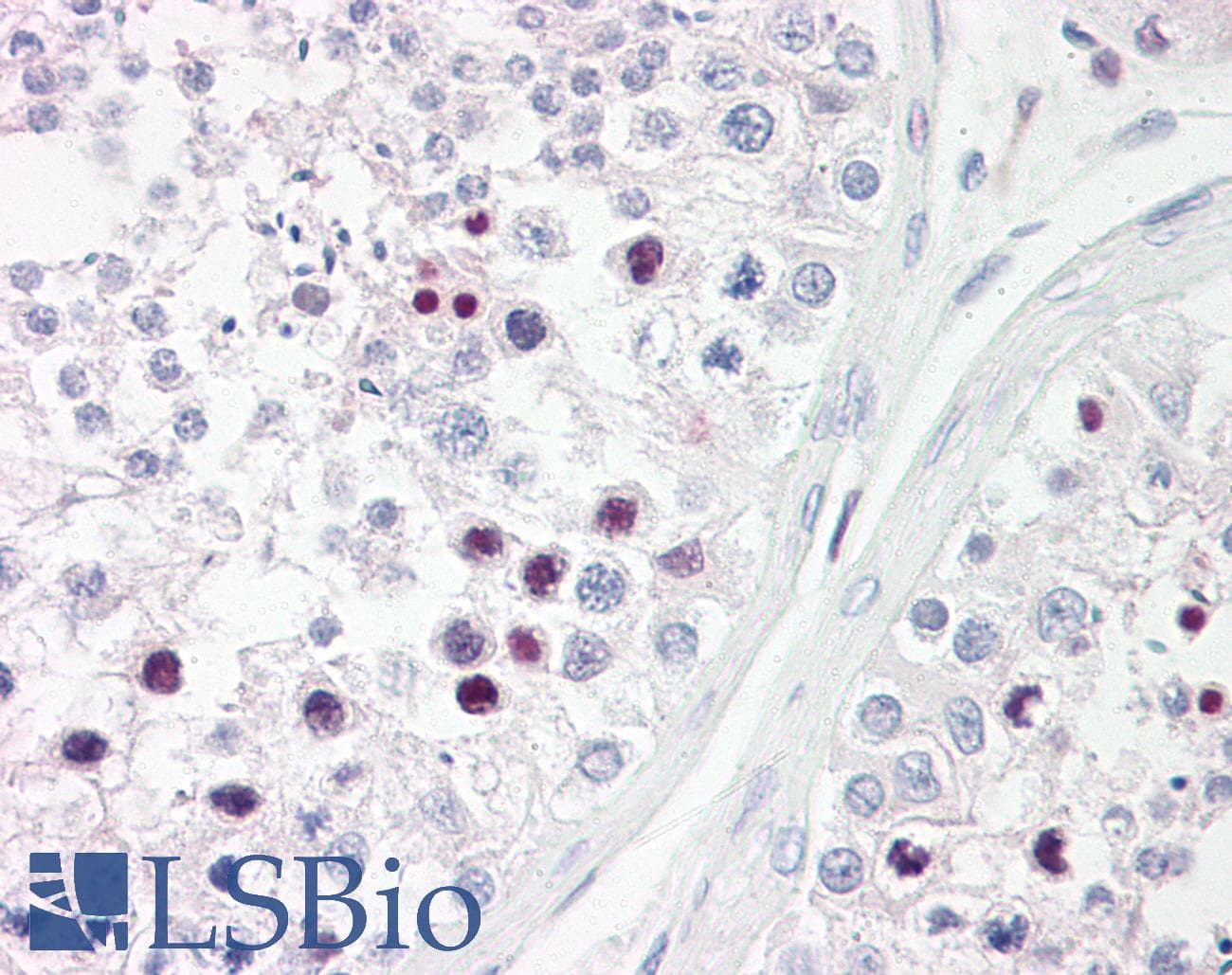 IHC-plus™ RFX3 Antibody (aa641-690)