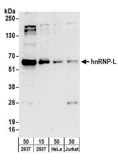 ACLY / ATP Citrate Lyase Antibody (aa1051-1101)