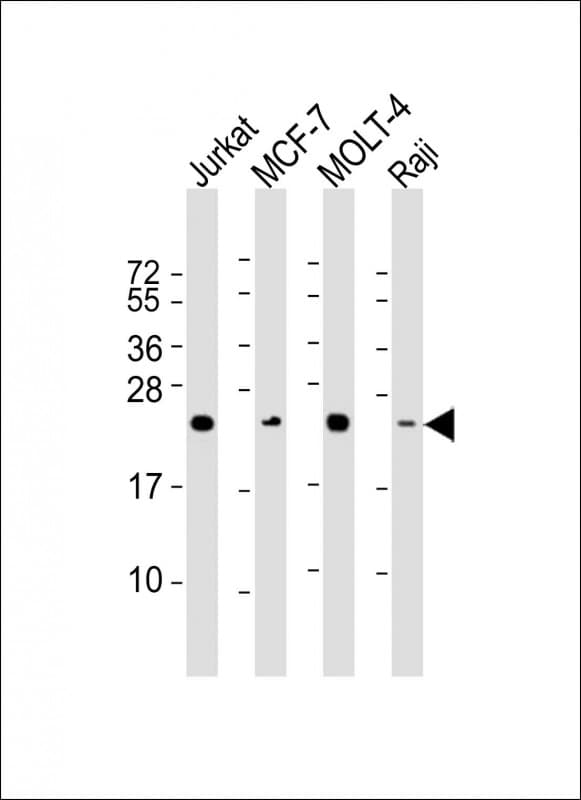 MGMT Antibody (clone 1527CT158.87.44)