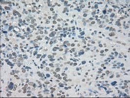 SATB1 Antibody (clone OTI13D6)