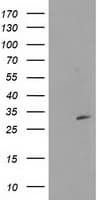 CTDSP1 / SCP1 Antibody (clone OTI1D3)