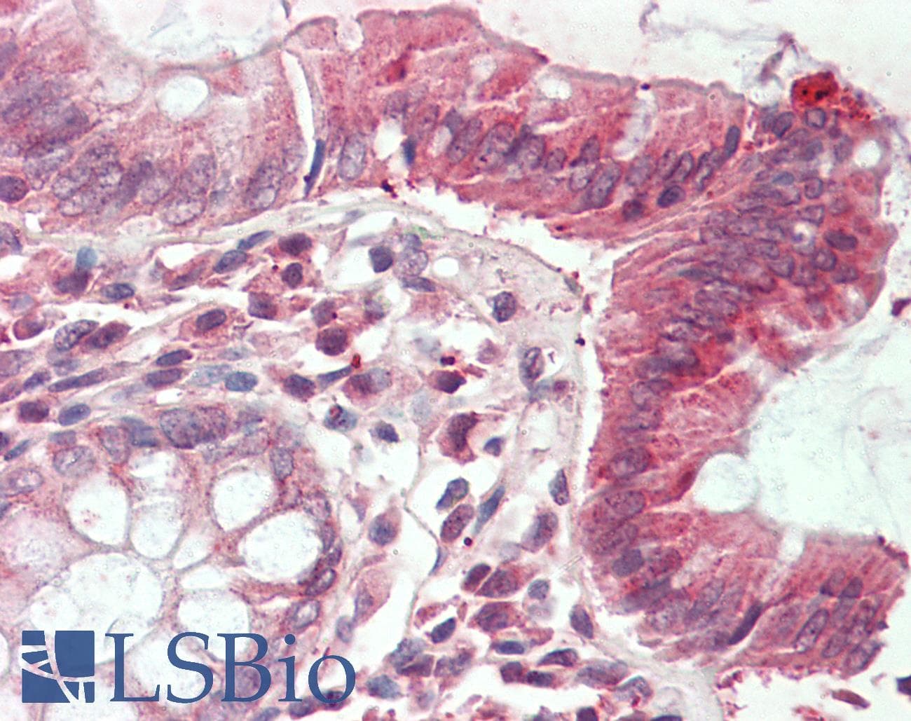 IHC-plus™ Polyclonal Goat anti-Human CLIC1 / NCC27 Antibody (aa71-82, IHC, WB)