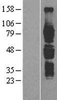 IL6R / IL6 Receptor Protein (Over-Expression Lysate Myc-DDK (Flag))