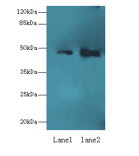 ABHD2 Antibody