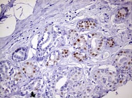 PR / Progesterone Receptor Antibody (aa1-298, clone OTI5C12)