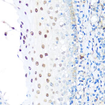 Polyclonal Rabbit anti-Human NAMPT / Visfatin Antibody (IHC, IF, WB)