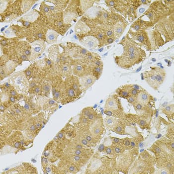 Polyclonal Rabbit anti-Human TSC501 / NAT8 Antibody (IHC, WB)