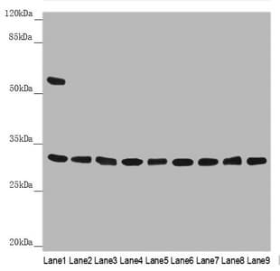 HCCS Antibody