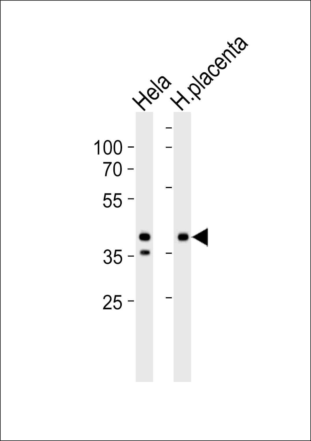 IDH3B Antibody (aa15-49)