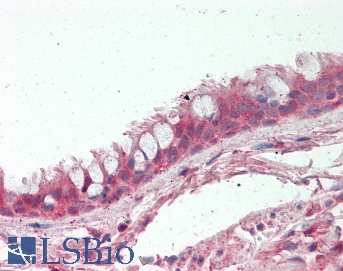 IHC-plus™ Polyclonal Rabbit anti-Human EDC3 Antibody (aa25-75, IHC, WB)