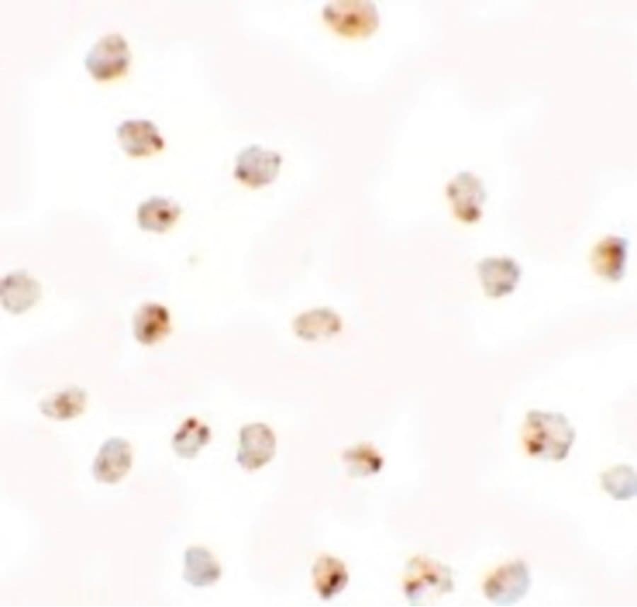 BMP15 Antibody
