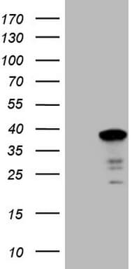 Monoclonal Mouse anti-Human SYF2 / p29 Antibody (clone OTI6A5, aa2-92, IHC, WB)