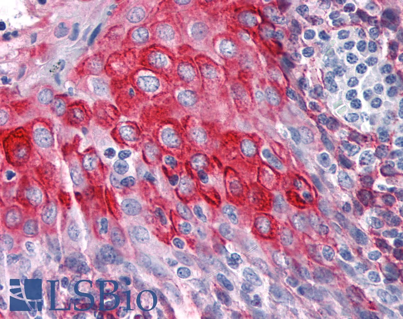 IHC-plus™ KRT15 / CK15 / Cytokeratin 15 Antibody (clone 6E7)