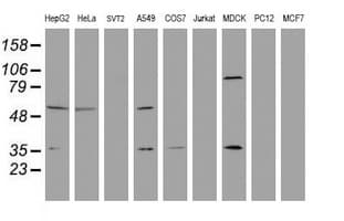EPHX1 / Epoxide Hydrolase 1 Antibody (aa21-230, clone OTI4G4)