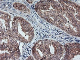 Monoclonal Mouse anti-Human PPP1R15A / GADD34 Antibody (clone OTI4F1, IHC, IF, WB)