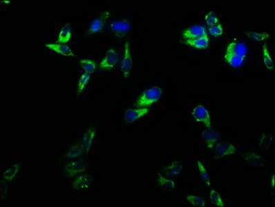 PathPlus™ Polyclonal Rabbit anti-Human CD2 Antibody (aa25-209, IHC, IF)