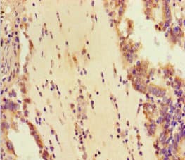 Polyclonal Rabbit anti-Human DDX33 / DHX33 Antibody (IHC, IF, WB)