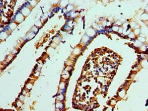 IHC-plus™ DEFA1 / Defensin Alpha 1 Antibody (aa1-94)