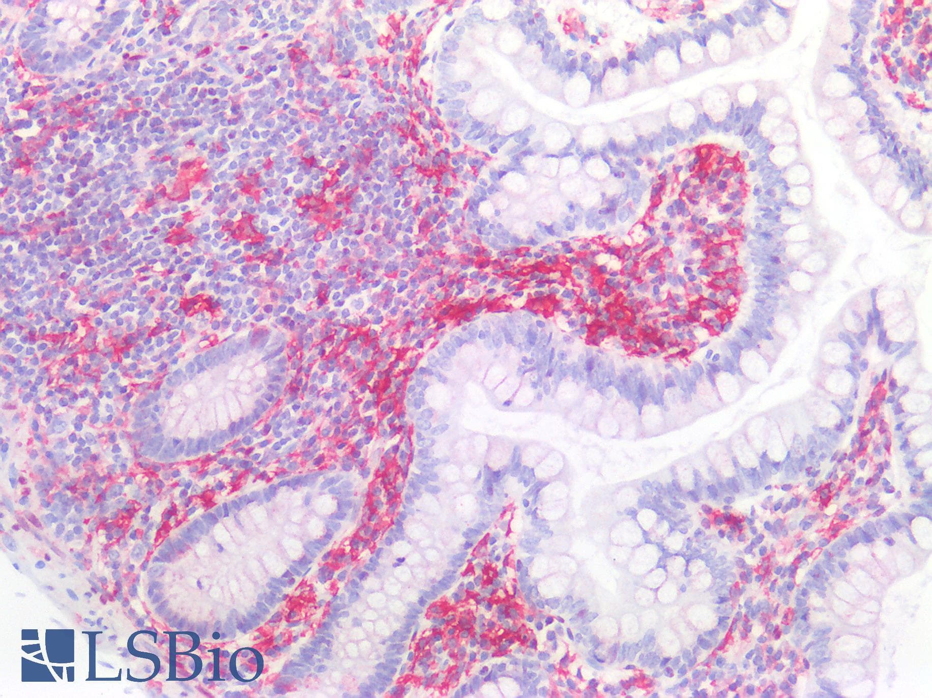 IHC-plus™ FCER1G Antibody