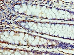 CSTF2 / CstF-64 Antibody (aa1-180)